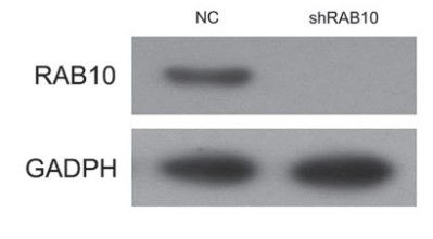 RAB10 protein levels in SMMC-7721 cells.jpg